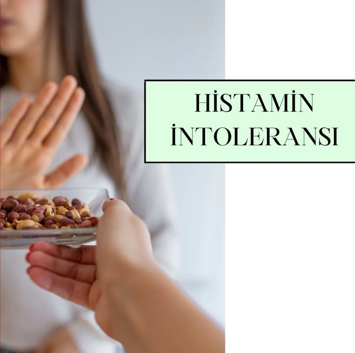 Histamin İntoleransı
